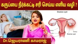 கருப்பை நீர்க்கட்டி சரி செய்ய எளிய வழி ? | Ovarian Cysts | Dr.Jeyarani Kamaraj |