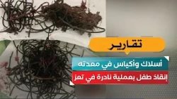 Wires and bags in his stomach.. Child saved in rare surgery in Taiz