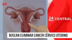 Chile podría eliminar el cáncer cérvico uterino antes de 2040, según estudio en The Lancet